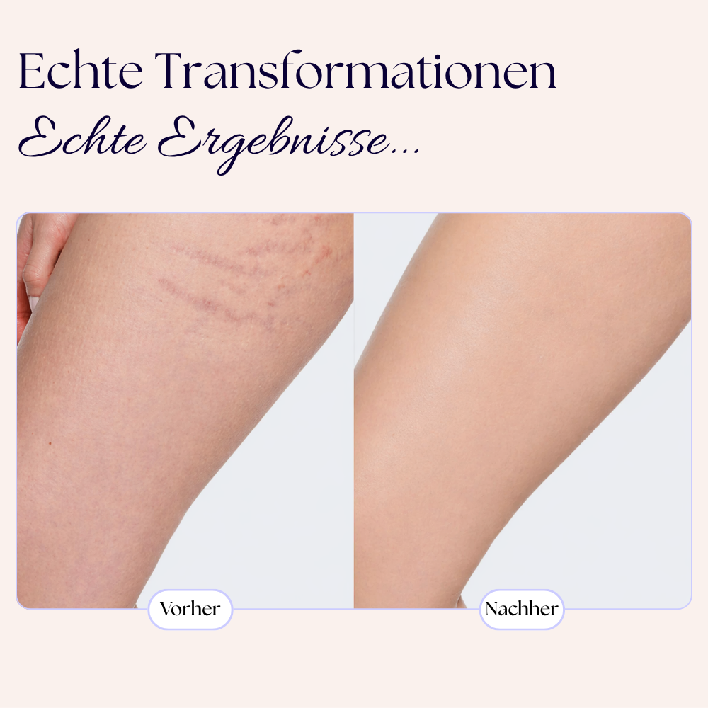 Skin Perfector™