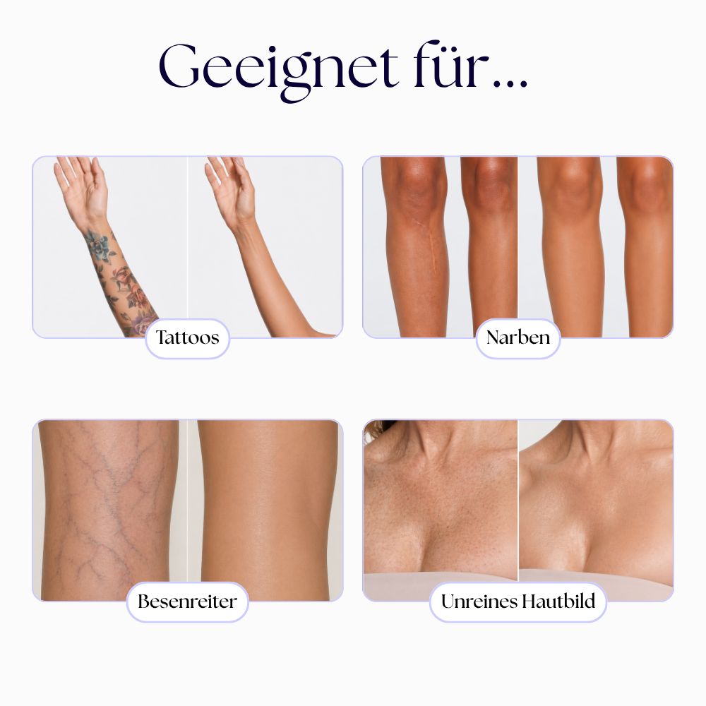 Skin Perfector™