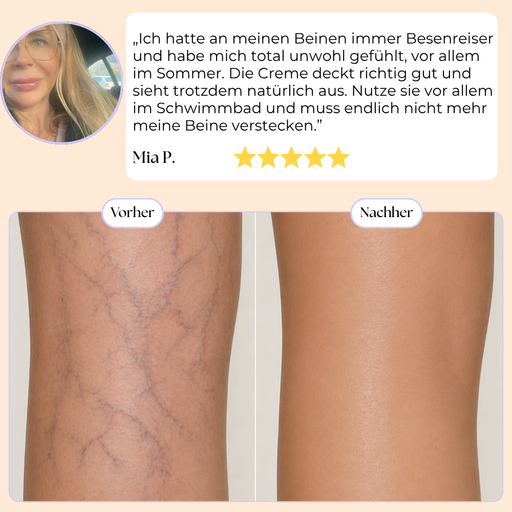 Skin Perfector™